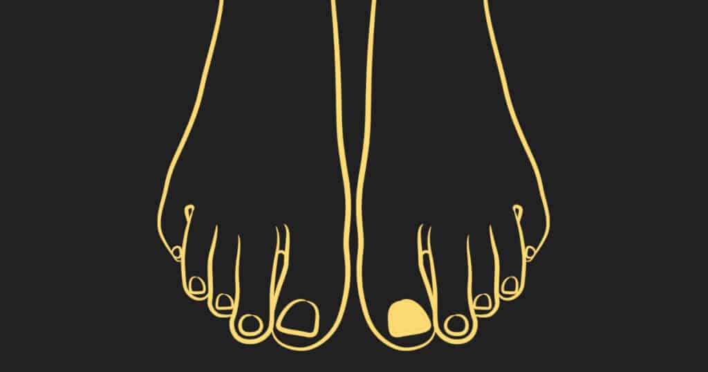 Mahabharata Parvas - Stri Parva - Featured Image - Picture of a man's feet with a discoloured toenail